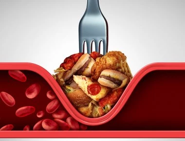 Οι τρεις δίαιτες που «ξεμπλοκάρουν» τις αρτηρίες